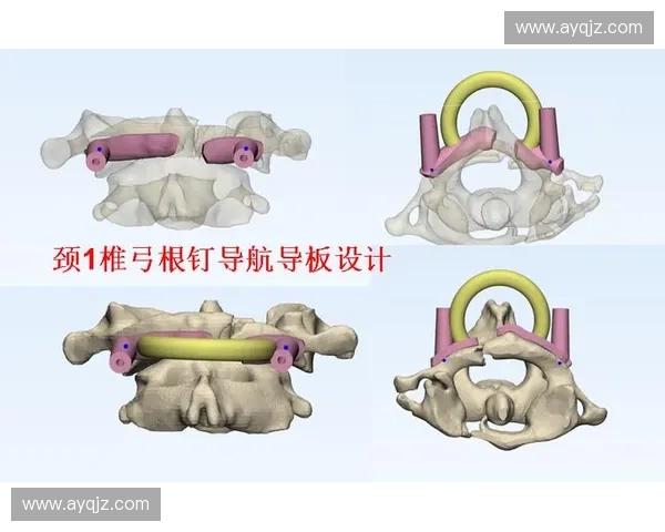 场地固定钉的应用原理与安装方法全面解析与实践指南